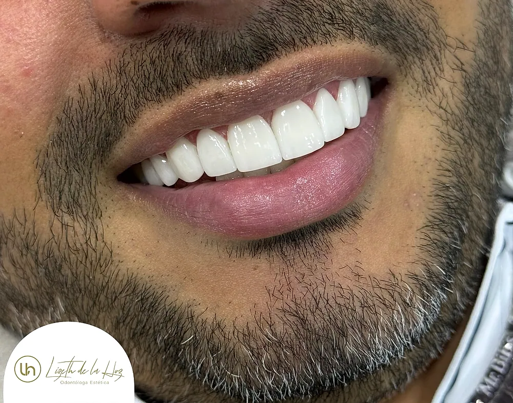 Sonrisa de paciente