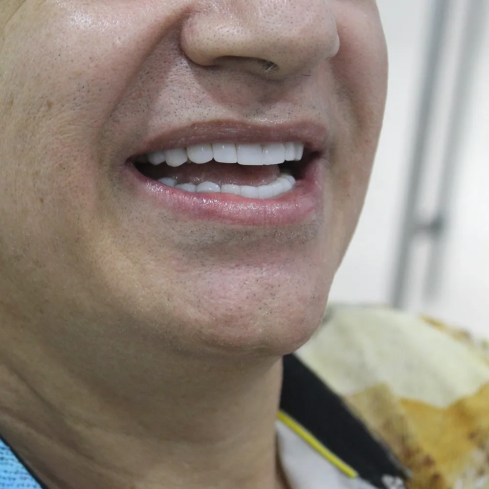 Sonrisa de paciente