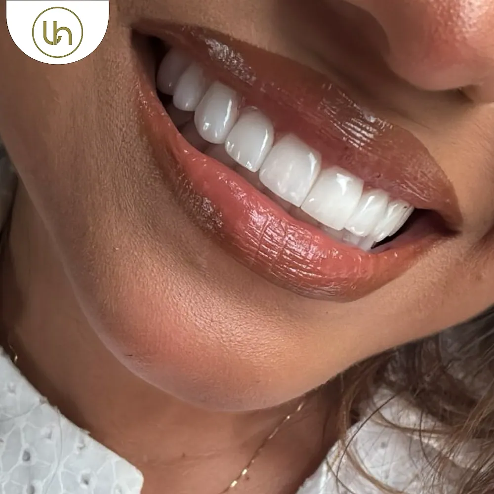 Sonrisa de paciente